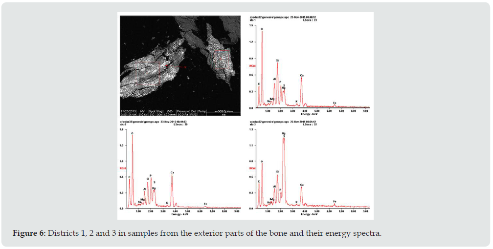 Click here to view Large Figure 6 Lupinepublishers-anthropological-and-archaeological-sciences