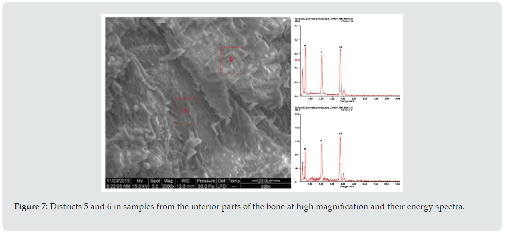 Click here to view Large Figure 7 Lupinepublishers-anthropological-and-archaeological-sciences