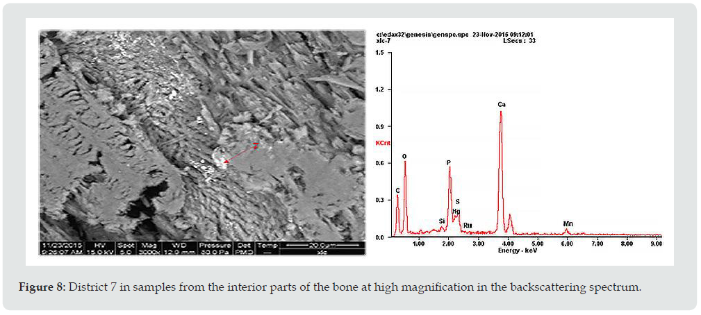 Click here to view Large Figure 8 Lupinepublishers-anthropological-and-archaeological-sciences