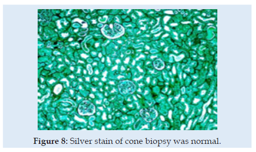 Lupinepublishers-openaccess-journals-anesthesia-pain-medicine-journal