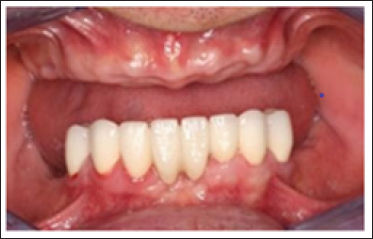 Lupinepublishers-openaccess-dentistry-oral-healthcare