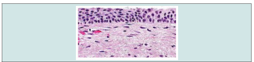 Click here to view Large Figure 2 Lupinepublishers-openaccess-drug-designing-journal