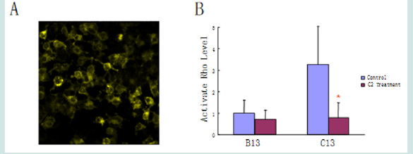 Click here to view Large Figure 8 Lupinepublishers-openaccess-drug-designing-journal