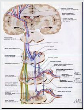 Lupinepublishers-online-journal-of-neurology-and-brain-disorders