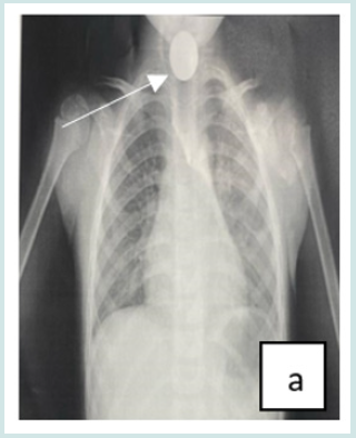 Click here to view Large Figure 1 Lupinepublishers-anthropological-and-archaeological-sciences