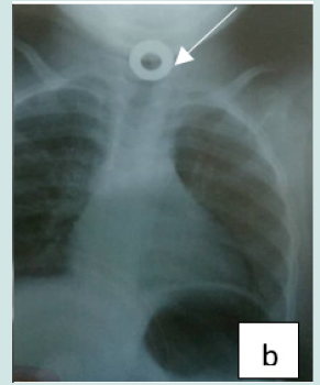 Click here to view Large Figure 2 Lupinepublishers-anthropological-and-archaeological-sciences