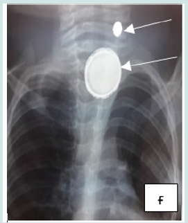 Click here to view Large Figure 6 Lupinepublishers-anthropological-and-archaeological-sciences