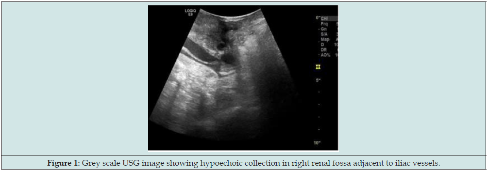 Click here to view Large Figure 1 lupinepublishers-openaccess-journal-urology-nephrology